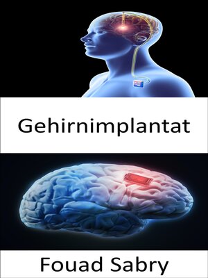 cover image of Gehirnimplantat
